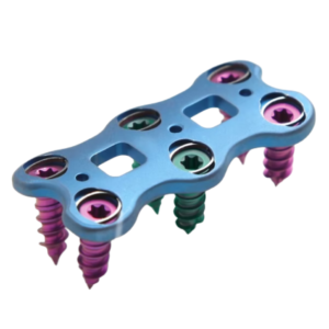 Placa Cervical